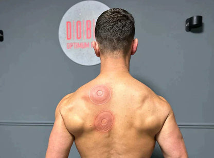 Portable Cupping Device